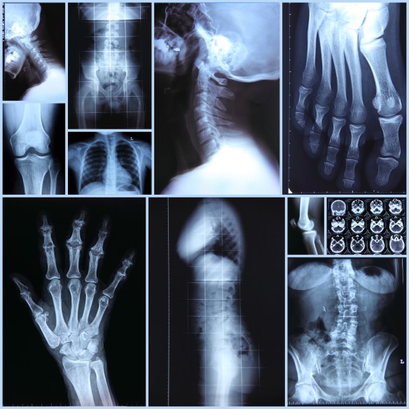 Radiography